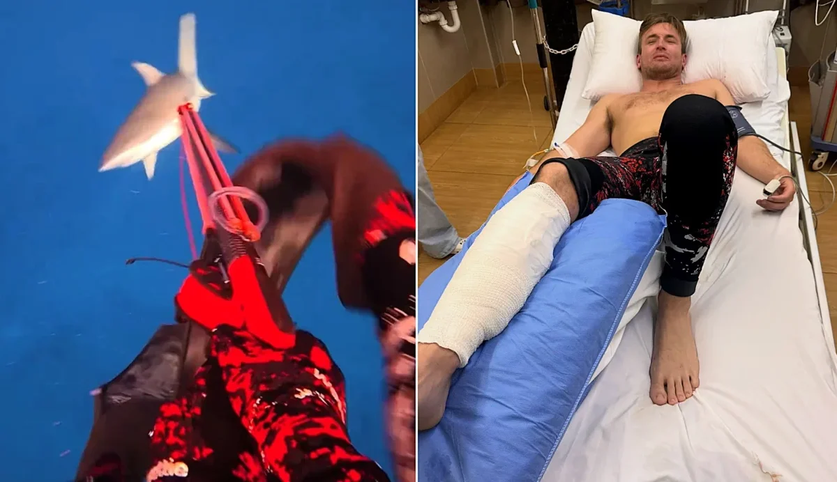 A shark savaged my leg on my first dive in Fiji – four surgeries later, I say the mistake was MINE - Creatorzine