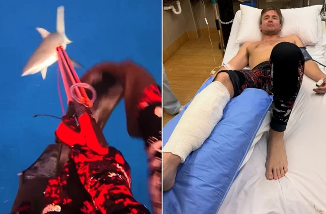 A shark savaged my leg on my first dive in Fiji – four surgeries later, I say the mistake was MINE - Creatorzine