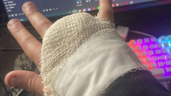 Streamer Lodk perde dedo no Rock in Rio e diz se arrepender | G1