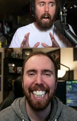 Asmongold Got His Teeth Fixed