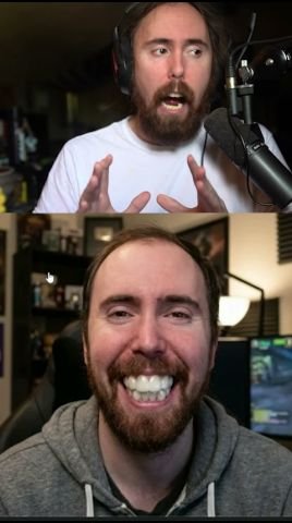 Asmongold Got His Teeth Fixed